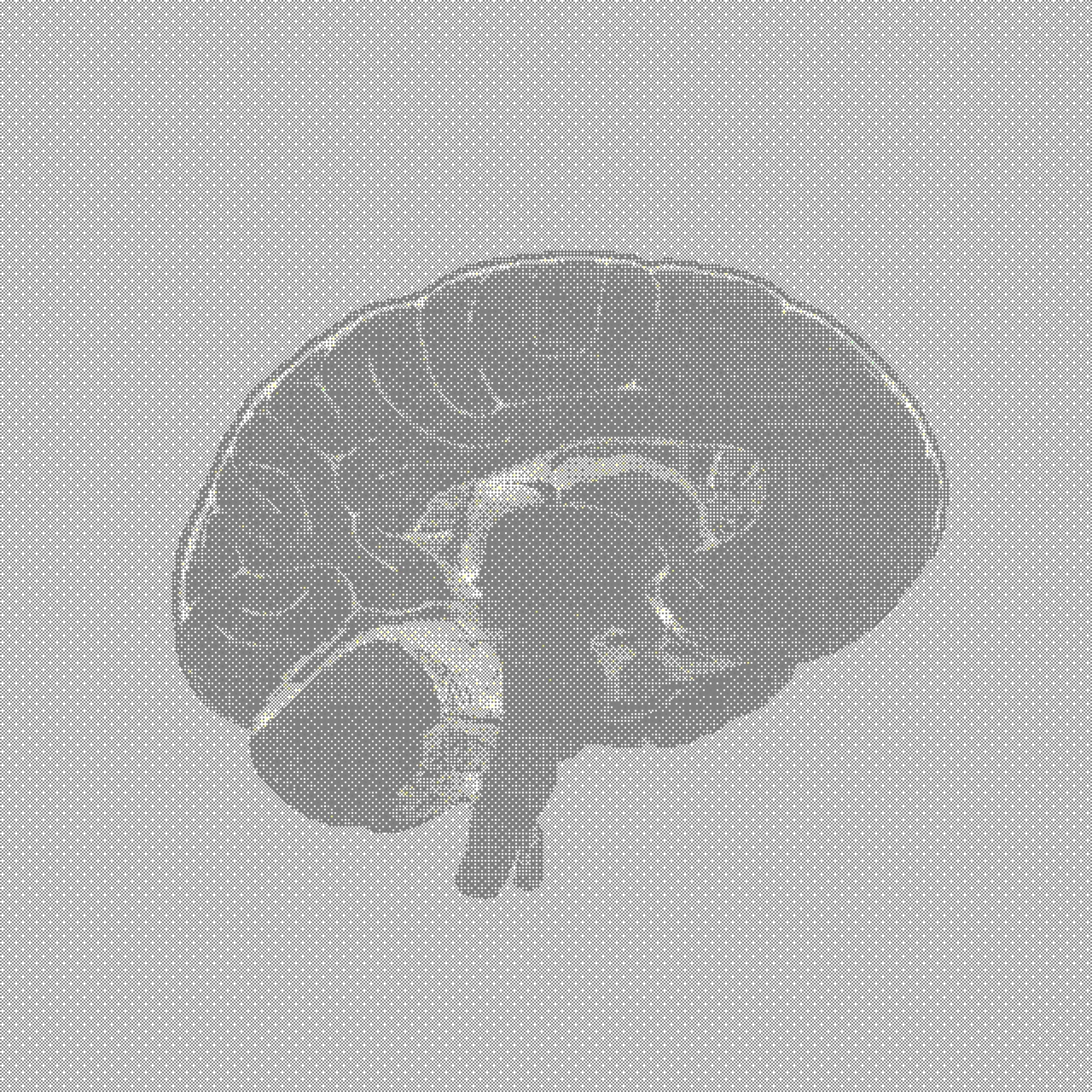 Visualizing Finger Therapy neurological impact
